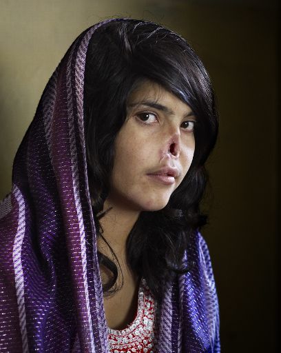 Pressefoto des Jahres: Von Taliban verstümmelte Afghanin