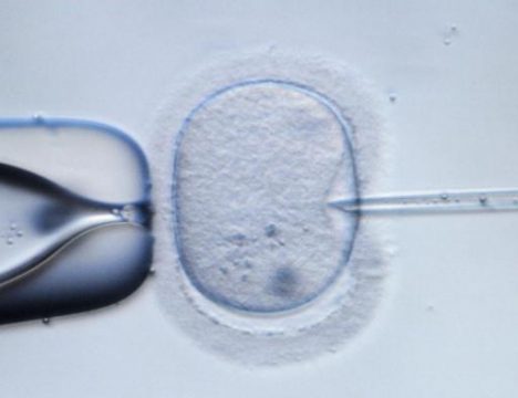In Vitro-Fertilisation (IVF)