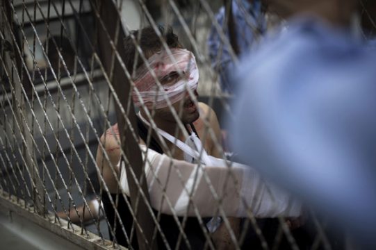 Verletzter syrischer Flüchtling auf dem Weg in die Türkei