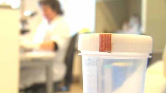 Zwei Babys nach Samenspende mit Erbkrankheit infiziert