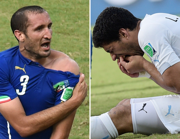 Giorgio Chiellini zeigt die Bisswunde - Luis Suarez hält sich das Gebiss