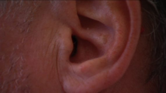 Tinnitus - Was tun wenn es im Ohr flötet