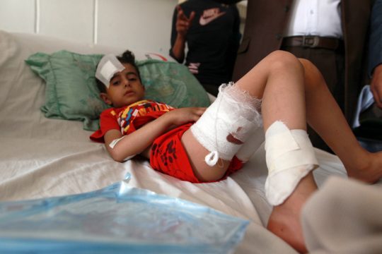 Verwundetes Kind aus dem Jemen in einem Krankenhaus in Sanna (21.3.)