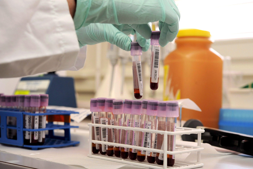 Analyse von Blutproben im Labor (Illustrationsbild: Dominic Favre/AFP)