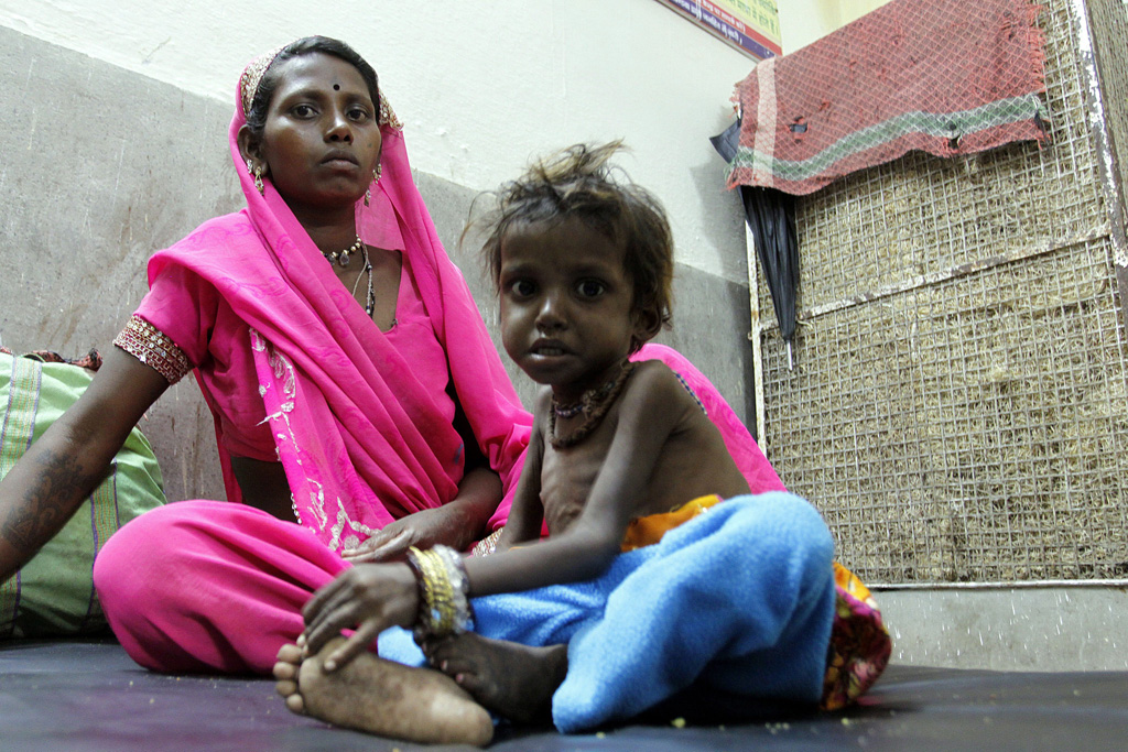 Mutter mit ihrem unterernährten Kind in einem Gesundheitszentrum in Khandwa, Indien
