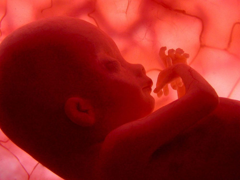Feinstaub schadet ungeborenen Babys