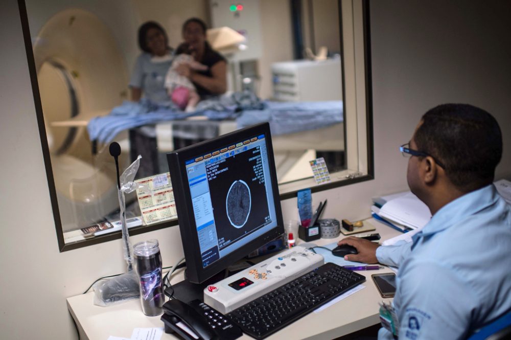 Ärzte scannen das Gehirn eines Neugeborenen im Krankenhaus Obras Sociais Irma Dulce in Salvador, Brasilien, um eine mögliche Zika-Infektion festzustellen (27.1.)