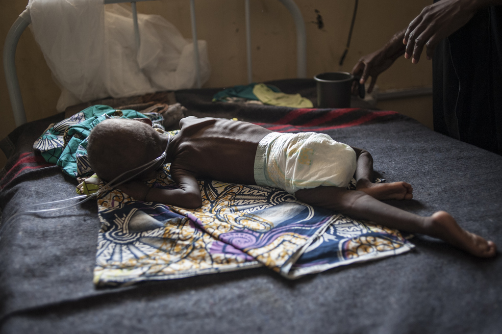 Unterernährtes Kind in einem medizinischen Zentrum in Maiduguri (Borno, Nordost-Nigeria)