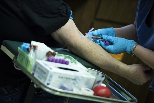 Patient hält Arm für eine Infusion