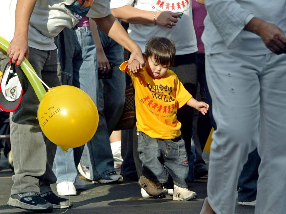 Junge mit Down-Syndrom