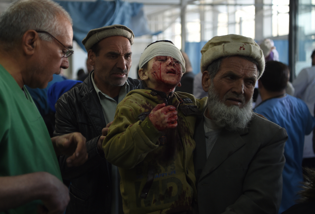 Verletztes Kind in Afghanistan