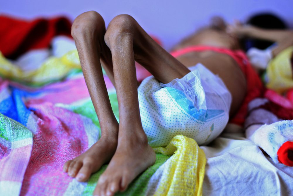Hungersnot im Jemen
