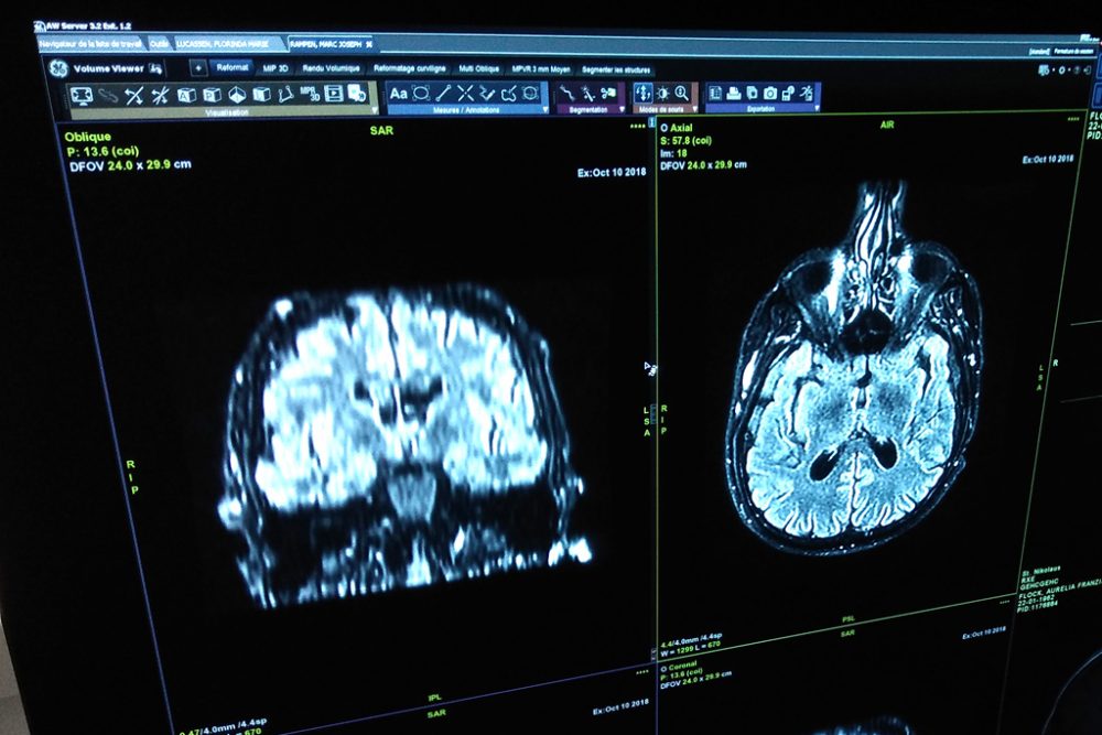 Neuer Magnet-Resonanz-Tomograph im Eupener Krankenhaus