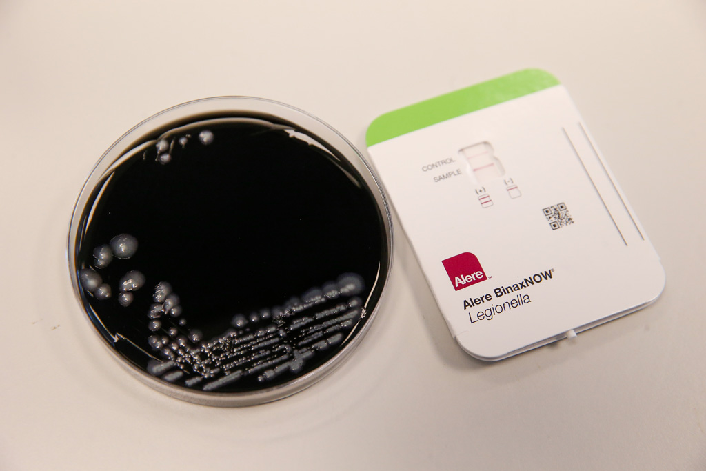 Test für Legionella-Bakterien