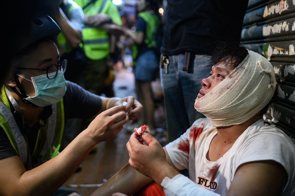 Proteste in Hongkong (Bild: Philip Fong/AFP)