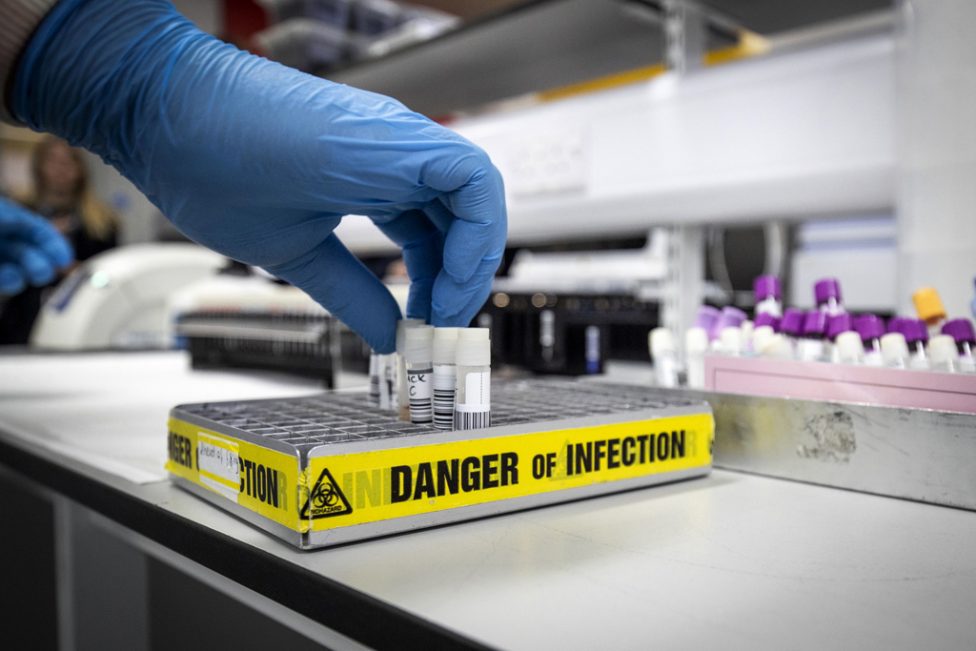 Probenhalter in Labor mit Aufschrift "Danger of Infection", Gummihandschuh-Hand fässt eine der Proben an