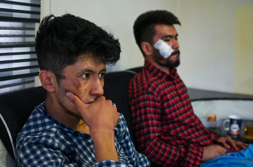 Die verletzten afghanischen Journalisten Nematullah Naqdi (r.) und Taqi Daryabi nach ihrer Freilassung aus Taliban-Haft am 8.9. in Kabul (Bild: Wakil Kohsar/AFP)