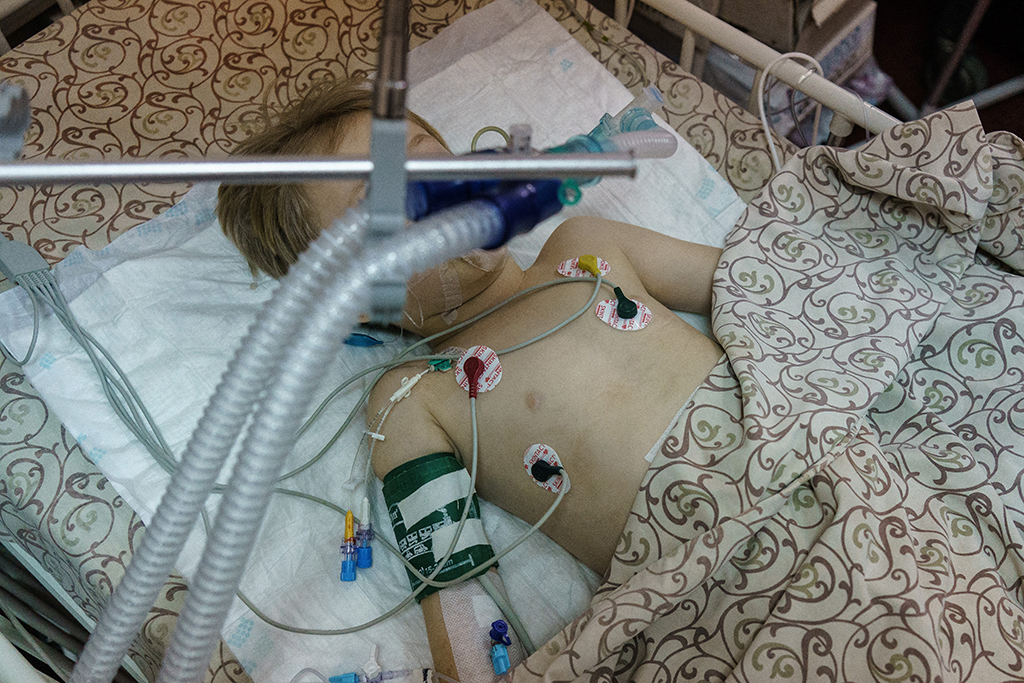 Ein schwerverletzter fünfjähriger Junge in einem Krankenhaus in der ukrainischen Stadt Saporischschja (Bild: Emre Caylak/AFP)