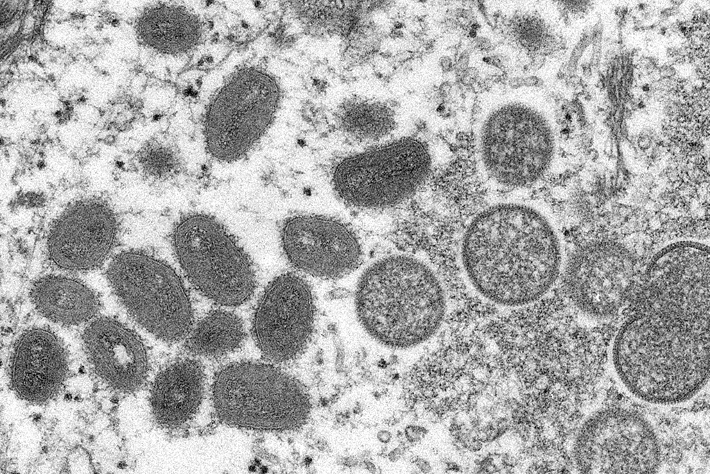 Das Affenpockenvirus unter einem Elektronenmikroskop (Archivbild: Cynthia S. Goldsmith/Centers for Disease Control and Prevention/AFP)