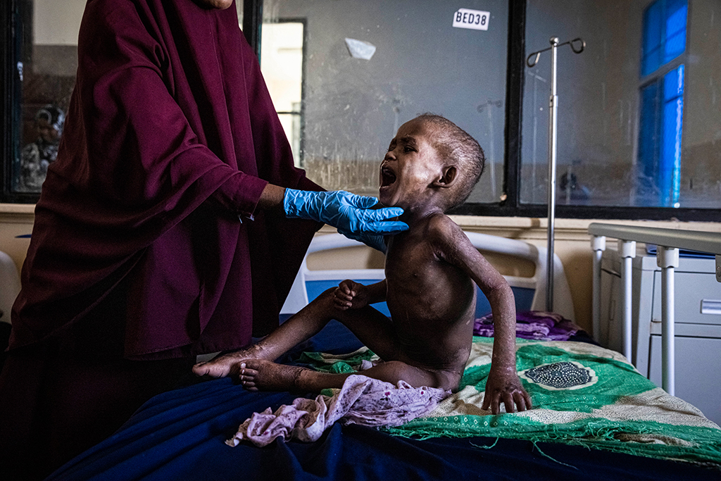 Im Banadir-Krankenhaus in Mogadischu, Somalia (Bild: Ed Ram/AFP)