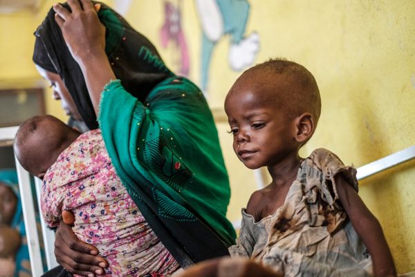 Unterernährtes Kind in einem Gesundheitszentrum im äthiopischen Kelafo (Bild: Eduardo Soteras/AFP)