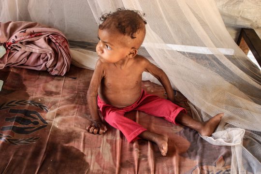 Hungersnot (Illustrationsbild: Essa Ahmed/AFP)
