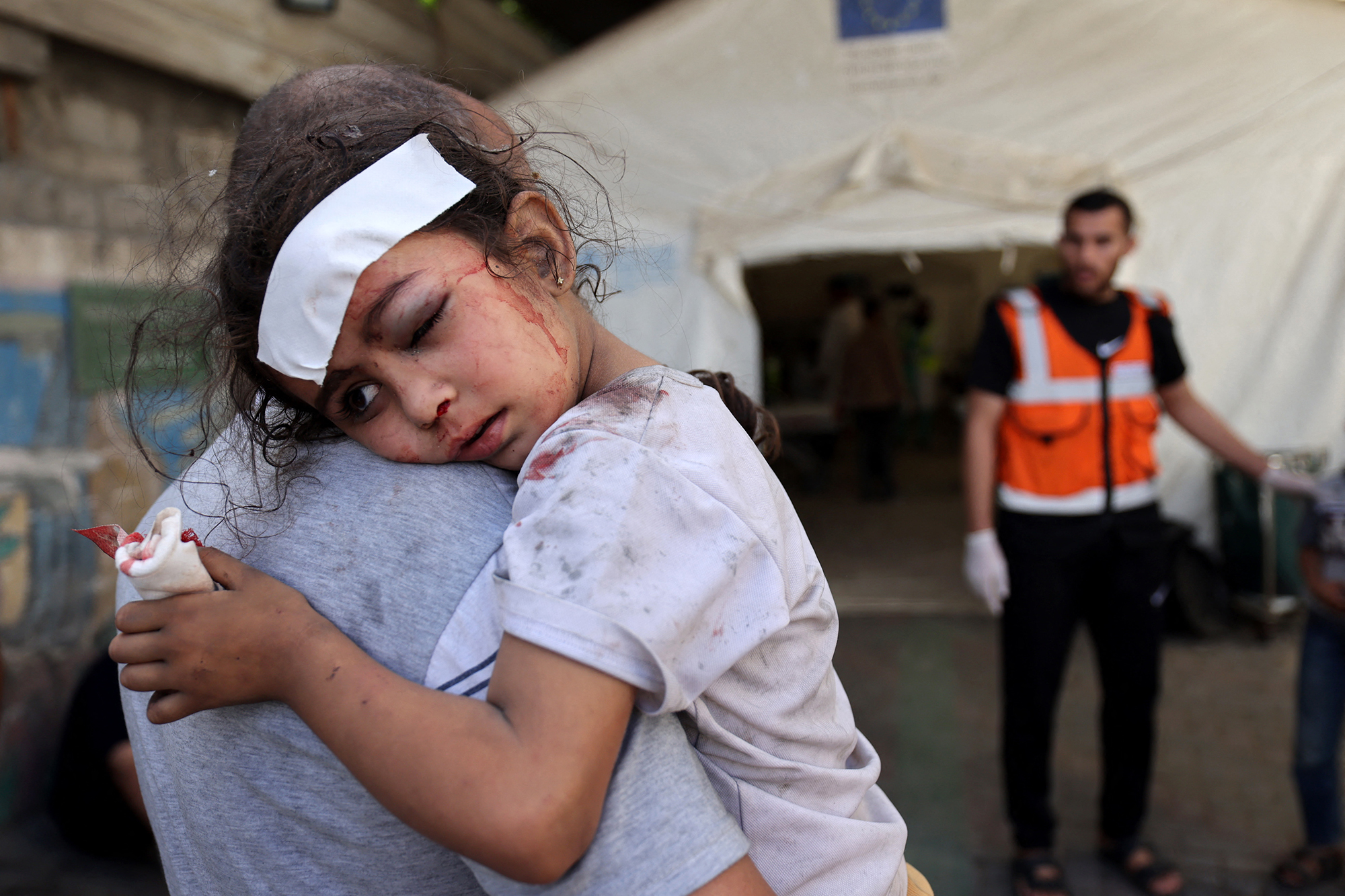 Verletztes Mädchen nach israelischem Luftangriff am 17. Oktober (Bild: Mohammed Abed/AFP)