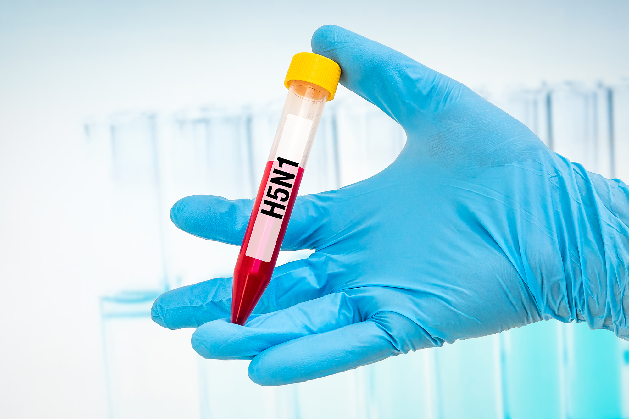 Reagenzglas mit Blutprobe für H5N1-Test (Illustrationsbild: © Bildagentur PantherMedia/andriano_cz)