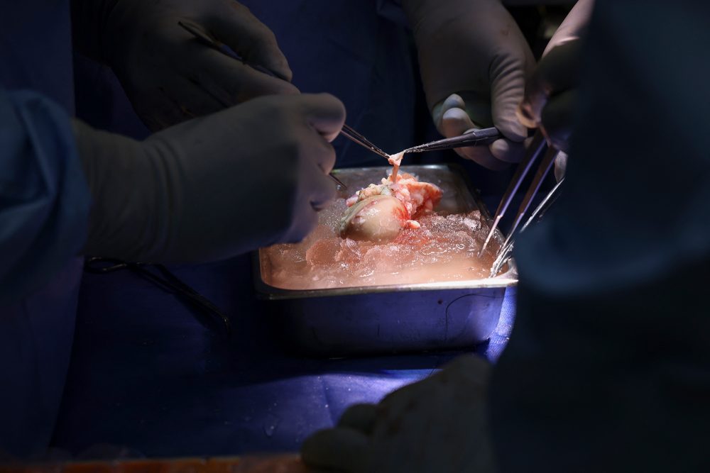 Die Schweineniere wird für die Transplantation vorbereitet