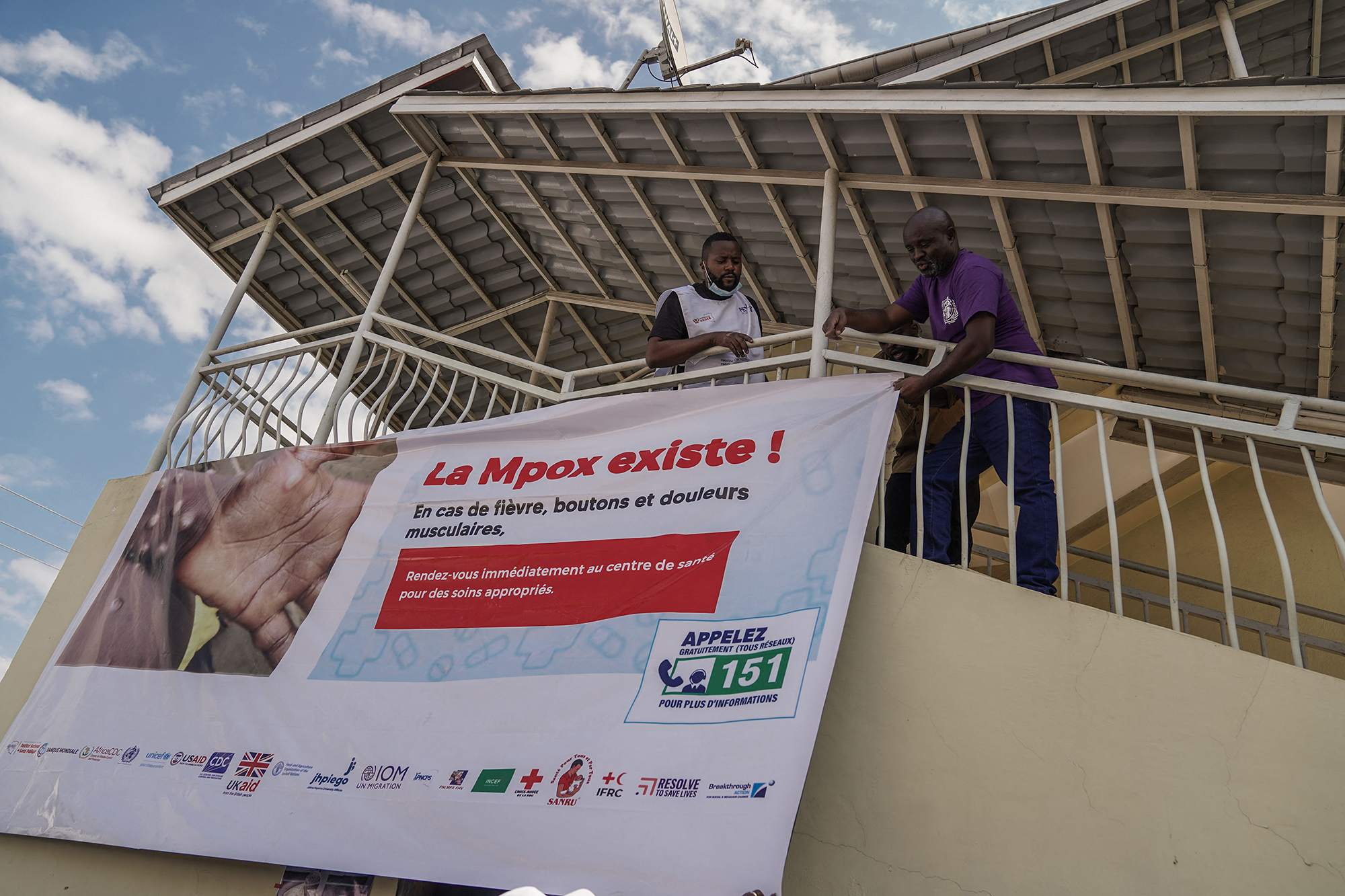 "Mpox existiert": Banner an einem Krankenhaus in Goma