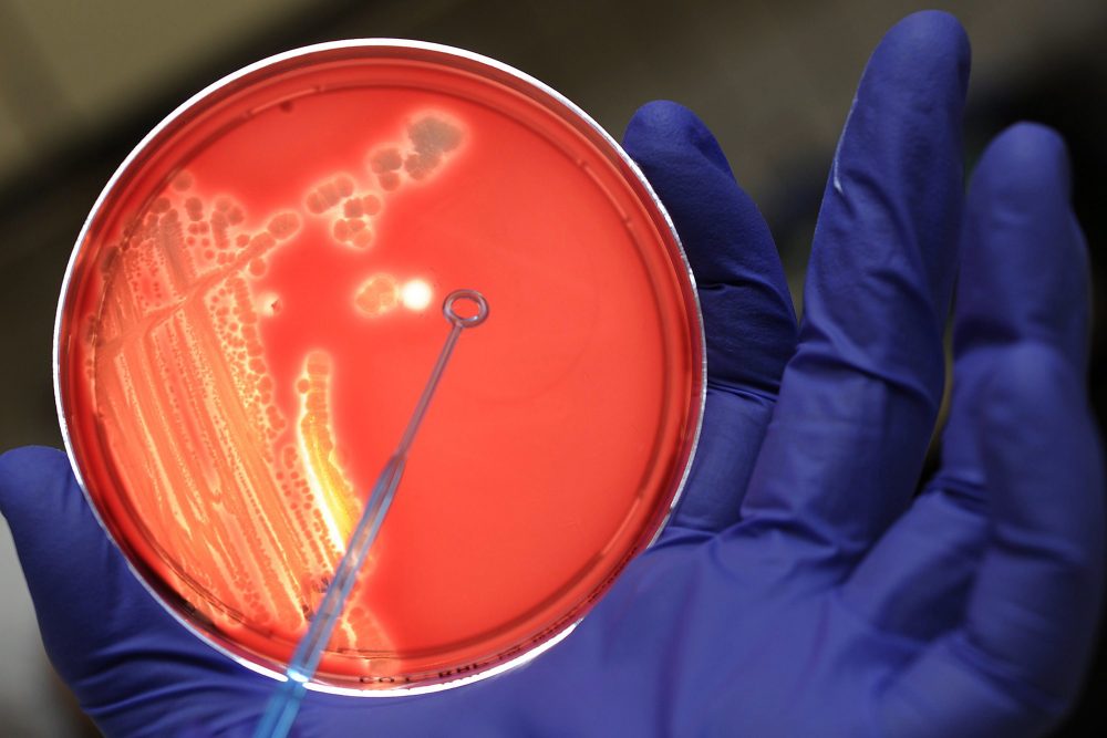 Nährboden mit Kulturen der E-coli- Bakterien