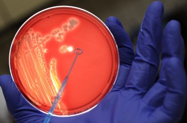 Nährboden mit Kulturen der E-coli- Bakterien