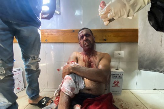 der verletzte Foto-Journalist sitzt am Boden