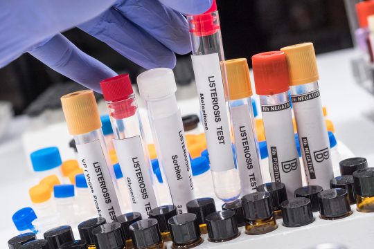 Listerien-Tests im Labor