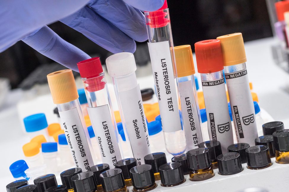 Listerien-Tests im Labor