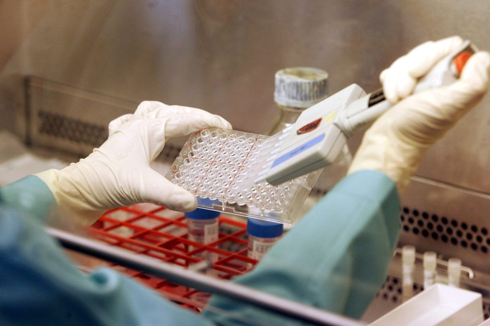 Hände einer Laborantin, die mit der Pipette Proben entnimmt